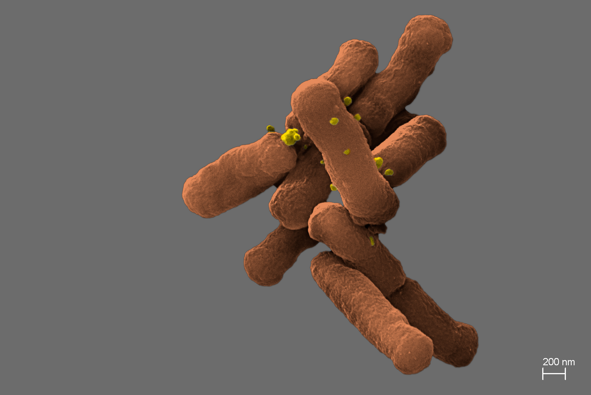 By isolating the D. oralis, ORNL scientists could better understand how the microbes may have adapted and evolved to become dependent on other oral bacteria, as well as how losing or acquiring genes can make them friend or foe. Credit: Karissa Cross/Oak Ridge National Laboratory, U.S. Dept. of Energy.