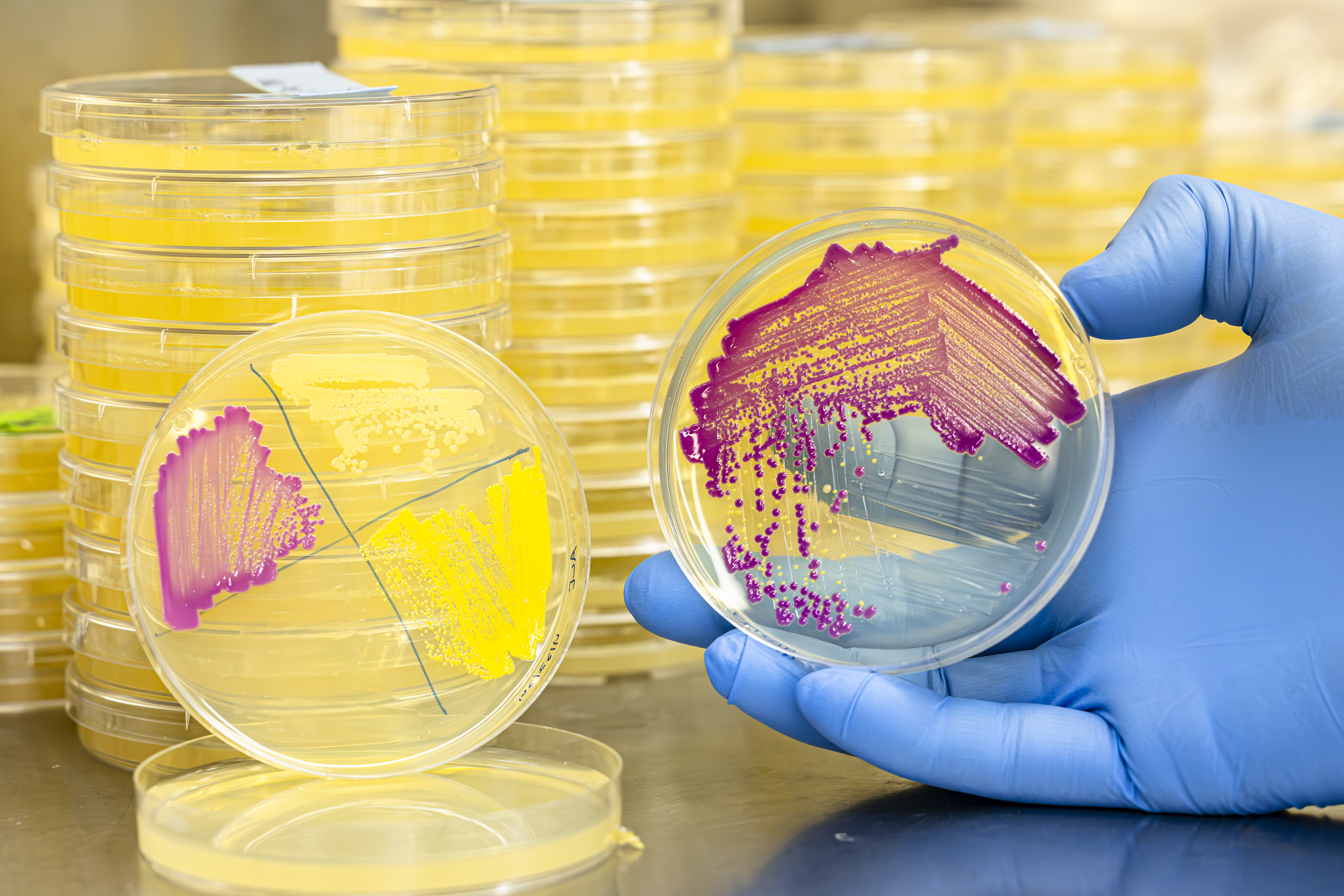 A hand wearing a blue latex glove holds a plate of vibrant magenta microbes towards the camera, stacks of vibrant yellow microbe plates are visible in the background